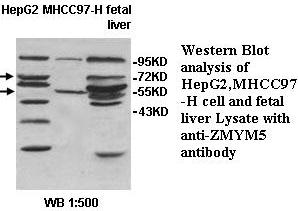 ZMYM5 Antibody