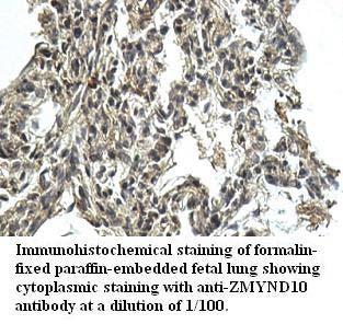 ZMYND10 Antibody