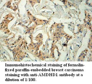 AMDHD1 Antibody