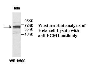 PGM1 Antibody