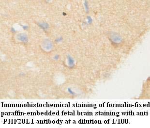 PHF20L1 Antibody