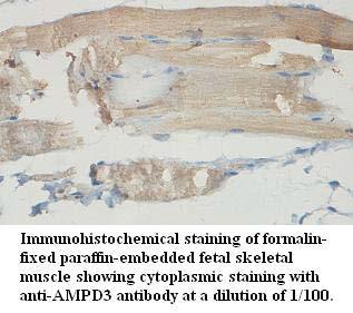 AMPD3 Antibody