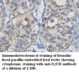 IQUB Antibody