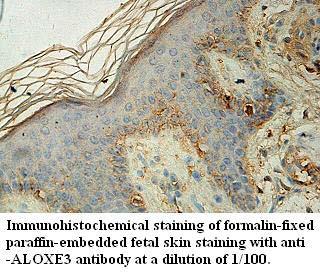 ALOXE3 Antibody