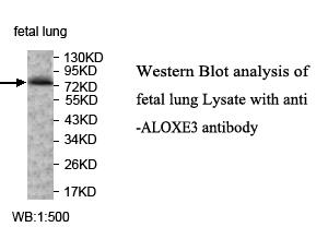 ALOXE3 Antibody