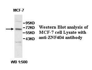 ZNF404 Antibody