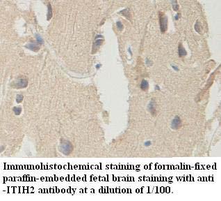 ITIH2 Antibody