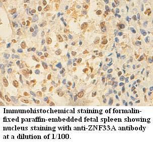 ZNF33A Antibody