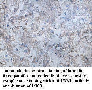 IWS1 Antibody