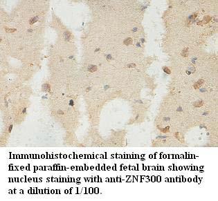 ZNF300 Antibody