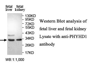 PHYHD1 Antibody