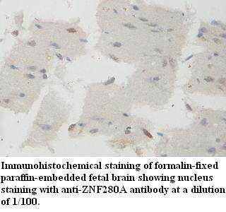 ZNF280A Antibody