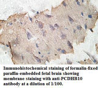 PCDHB10 Antibody