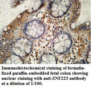 ZNF223 Antibody