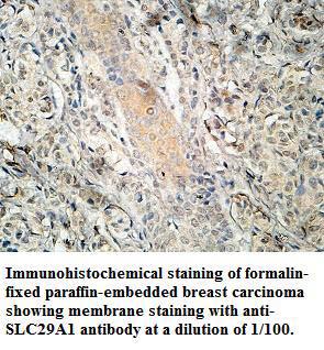 SLC29A1 Antibody