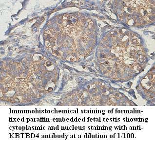 KBTBD4 Antibody