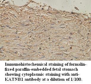 KATNB1 Antibody