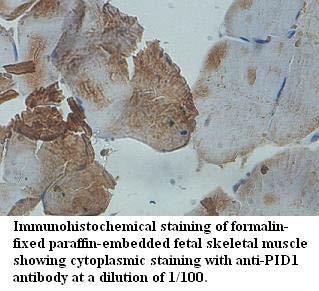 PID1 Antibody