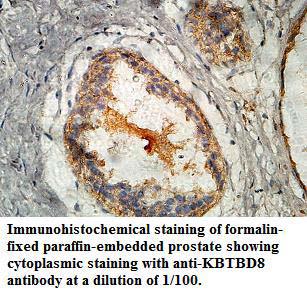 KBTBD8 Antibody