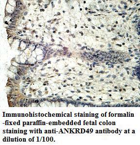 ANKRD49 Antibody