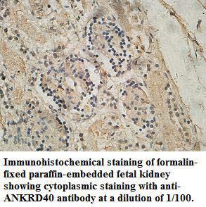 ANKRD40 Antibody