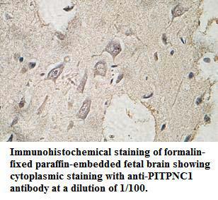 PITPNC1 Antibody