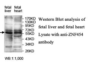 ZNF454 Antibody