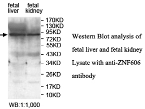 ZNF606 Antibody