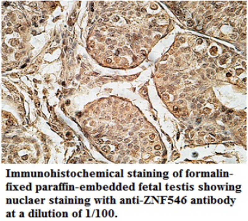 ZNF546 Antibody