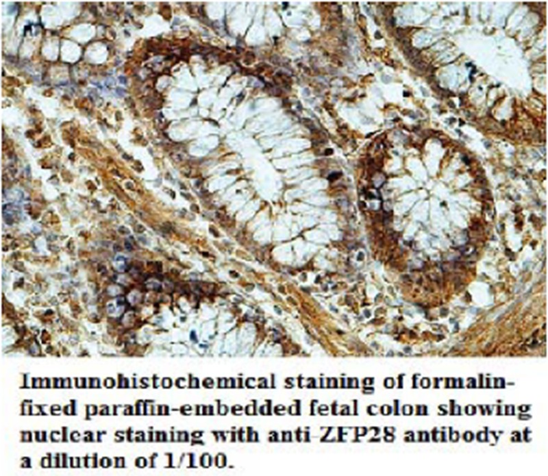 ZFP28 Antibody