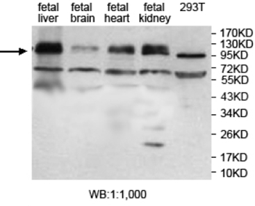 ZFP28 Antibody