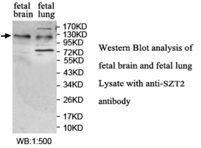SZT2 Anibody 