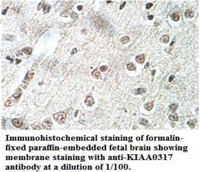 KIAA0317 Antibody