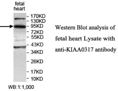 KIAA0317 Antibody