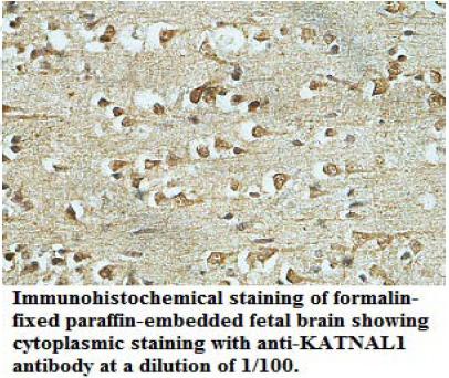 KATNAL1 Antibody