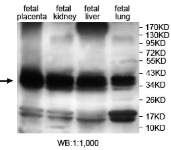 ANXA8L2 Antibody