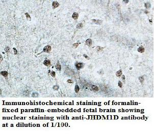 JHDM1D Antibody