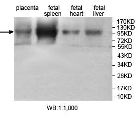 JHDM1D Antibody