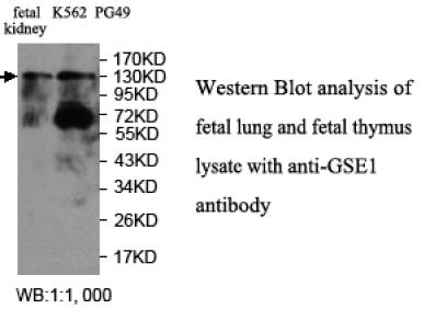 GSE1 Antibody