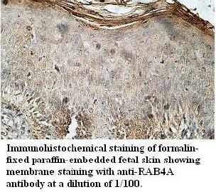 RAB4A Antibody