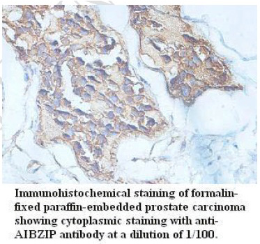 AIBZIP Antibody