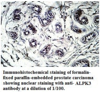 ALPK3 Antibody