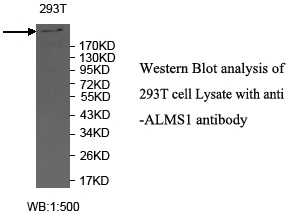 ALMS1 Antibody