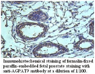 AGPAT9 Antibody