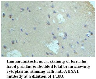 AHSA1 Antibody