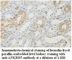 ANKRD5 Antibody