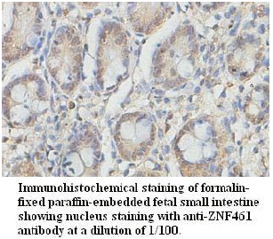 ZNF461 Antibody