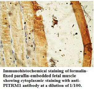 PITRM1 Antibody