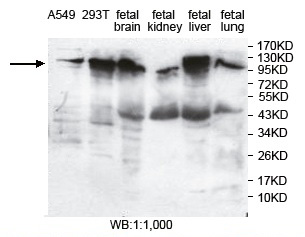 PITRM1 Antibody