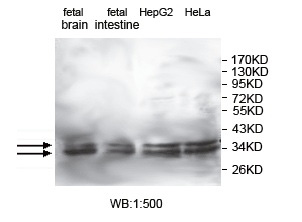 KCTD17 Antibody